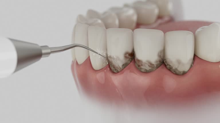 Reliable Dental Implants contractor in Pearson, GA by Smile Center Dentistry